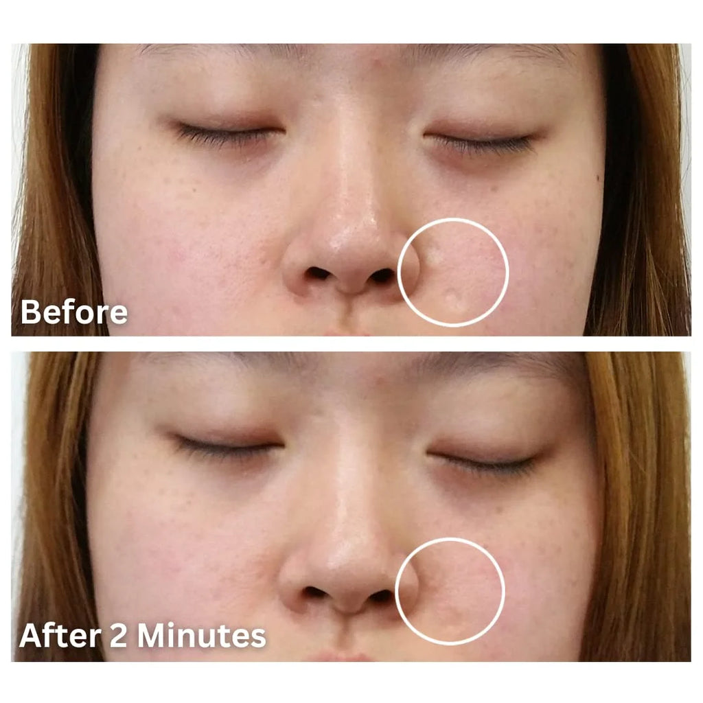 Bronze Medium Waterproof Scar Filler Concealer Refill Applicator K9826